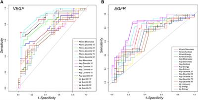 Association Between DCE-MRI Perfusion Histogram Parameters and EGFR and VEGF Expressions in Different Lauren Classifications of Advanced Gastric Cancer